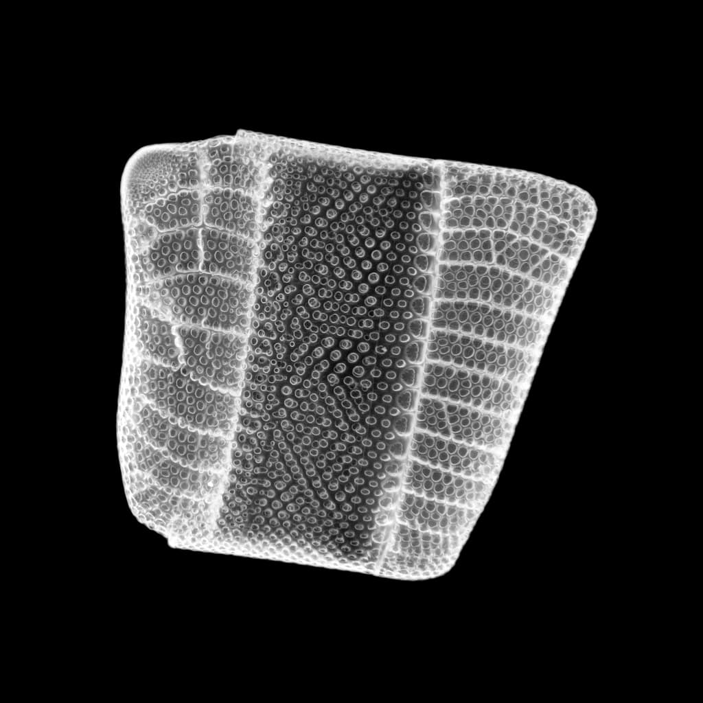 Diatom - Isthmia nervosa - 400x