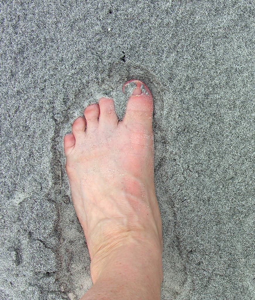 My Foot is Slipping